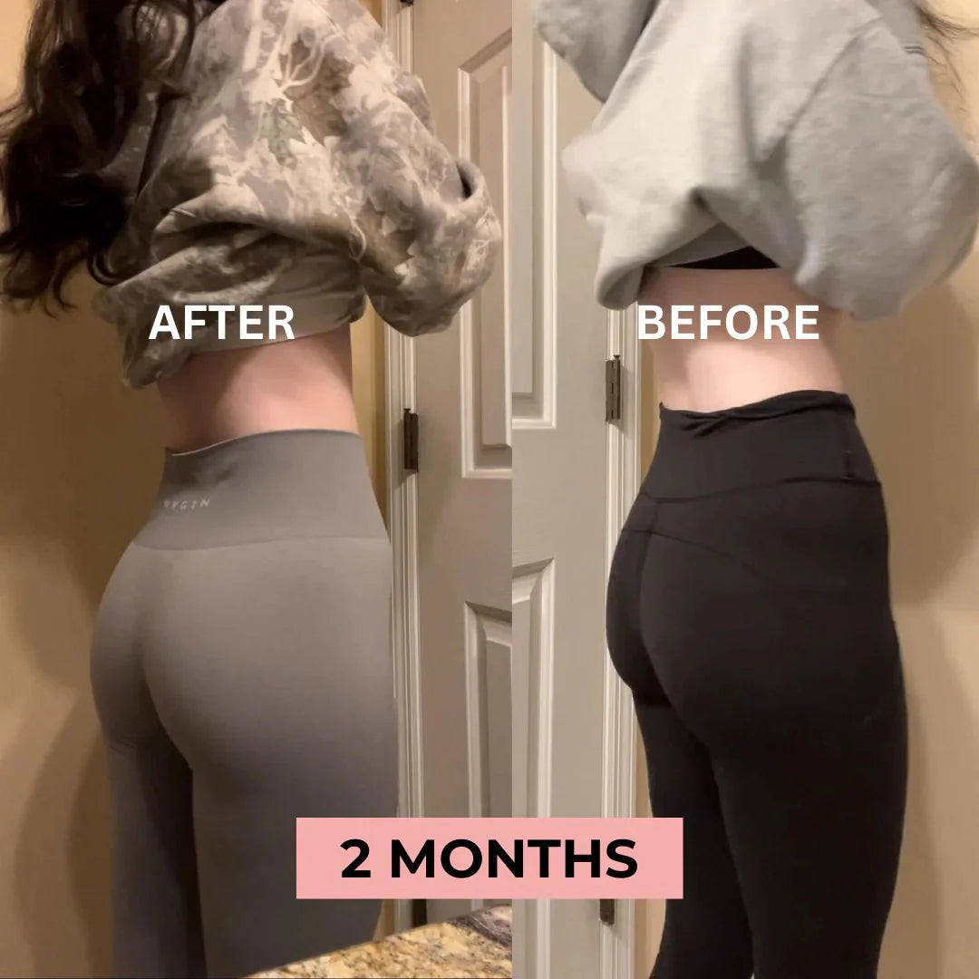🎁 [FREE GIFT BUNDLE] ToneUp™ Glutes Trainer