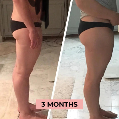🎁 [FREE GIFT BUNDLE] ToneUp™ Glutes Trainer